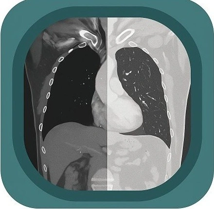 CT chest anatomy  anatomy icon